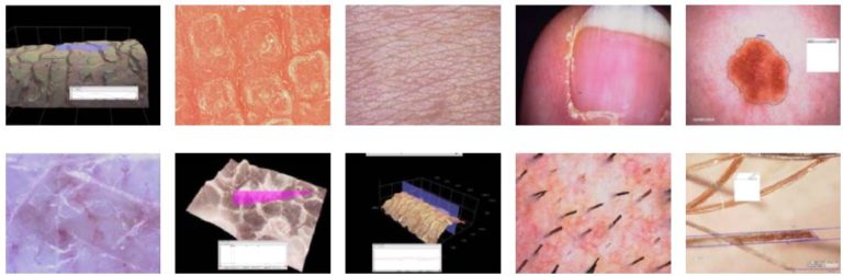 MICROSCOPIA DIGITALE 3D PER LA DERMATOLOGIA E LA COSMETICA