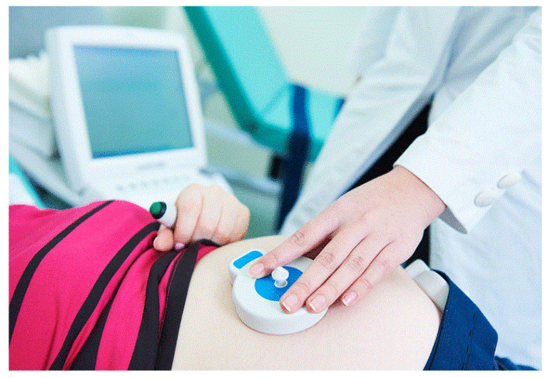 cardiotografia