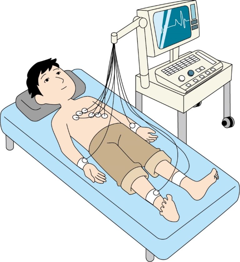 Cos’è l’ECG